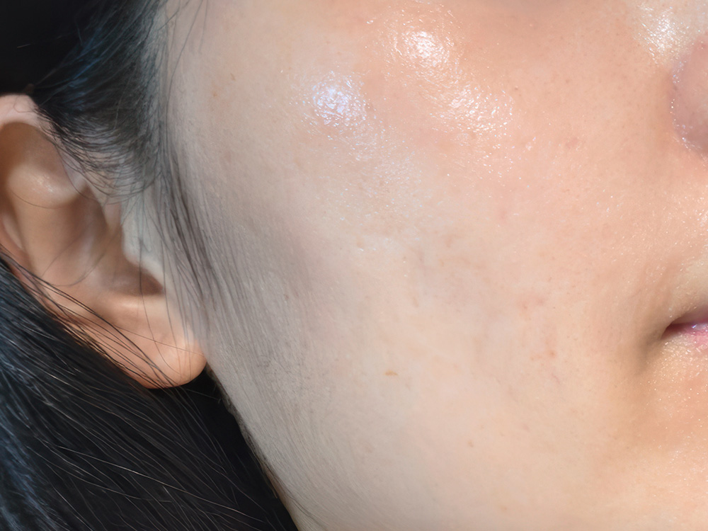Tester skin texture & radiance