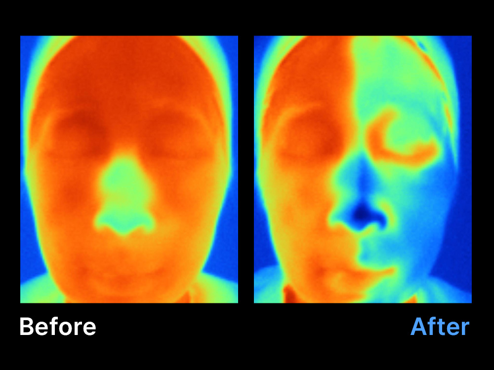 Thermal before-and-after comparison