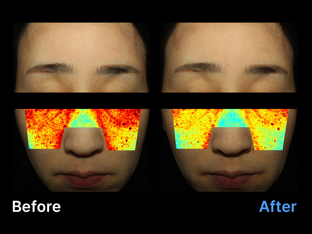 Pigmentation · before & after