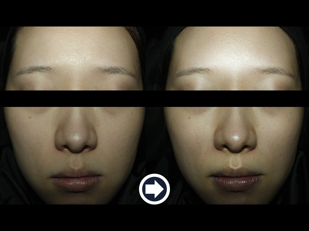 Radiance measurement · before & after